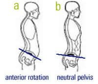 anterior-pelvic-tilt2.png